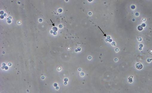 酵母双杂交技术原理、试验流程、特点以及应用