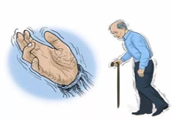 帕金森。芭痢辈慌？