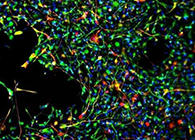 世界首创：药物将干细胞引导至受损部位，提高其愈合能力！