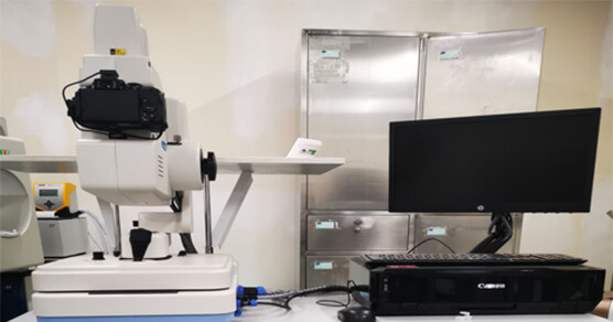 数字眼底造影检查仪