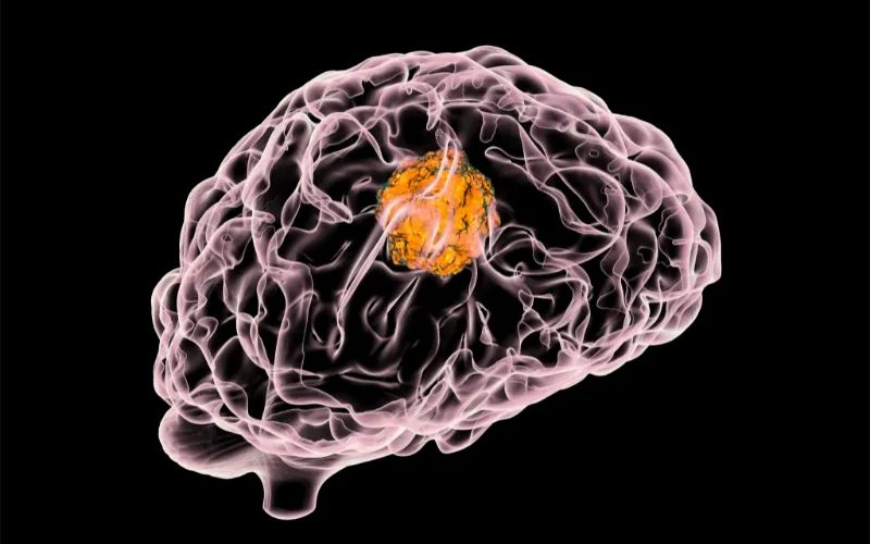 不朽情缘mg官网助力 | 璧辰医药ABM-1310获美国FDA孤儿药资格认证，用于治疗携带BRAF V600突变的脑胶质母细胞瘤患者